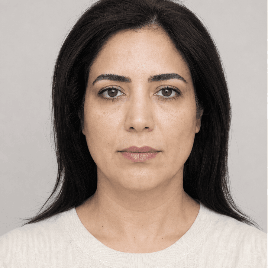 مقایسه شبیه‌سازی‌شده تناسب لب بالا پیش و پس از سانترال لب، نمای قبل
