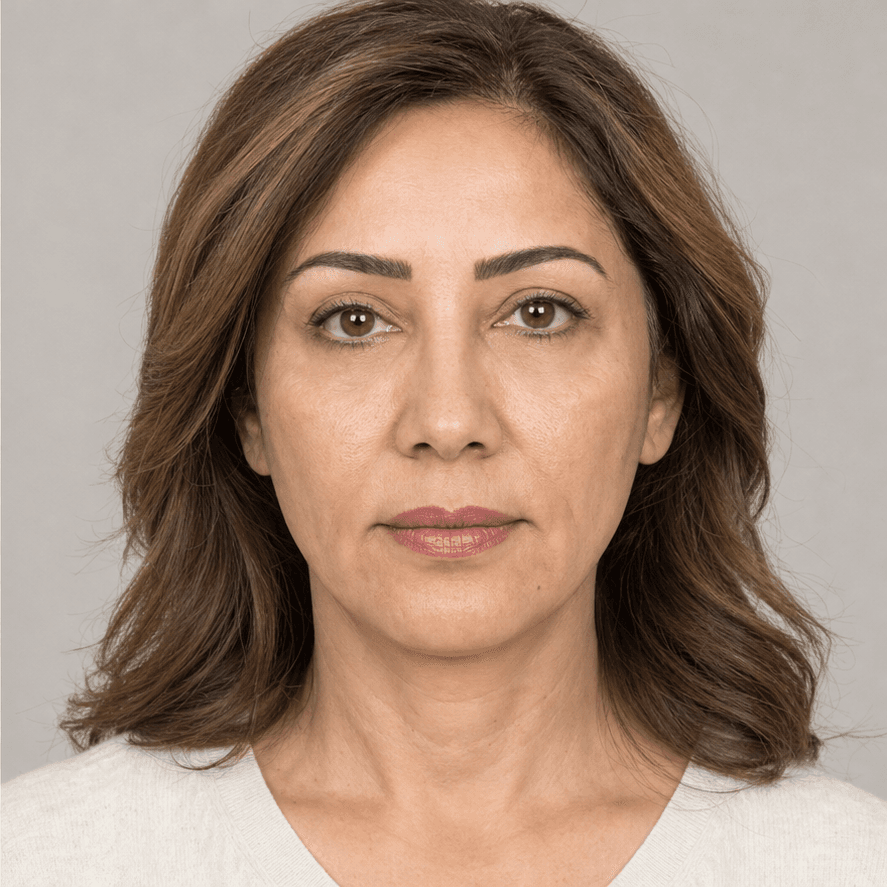 مقایسه شبیهسازیشده پلکها پیش و پس از بلفاروپلاستی محافظهکارانه، نمای بعد