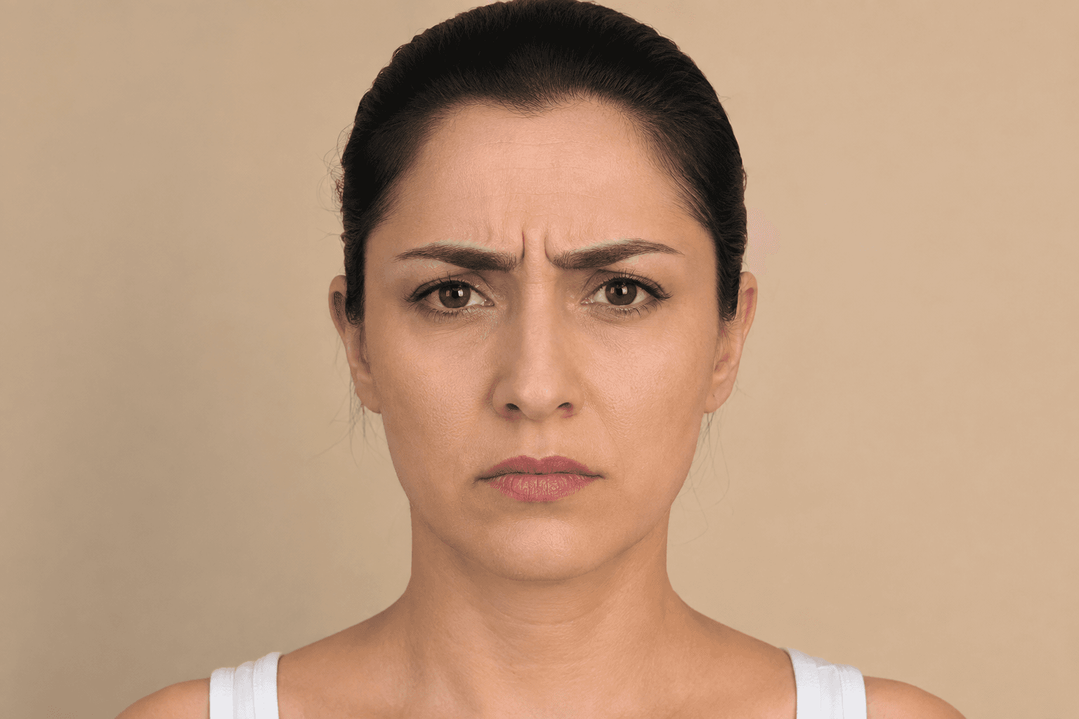 شبیهسازی مقایسه خطوط اخم فعال پیش و پس از کاهش ملایم خطوط، نمای قبل